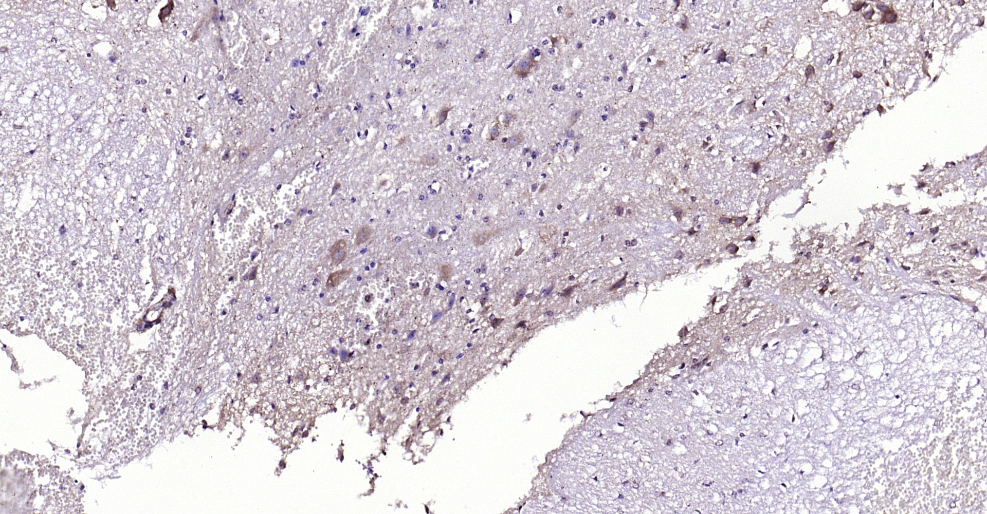 Paraformaldehyde-fixed, paraffin embedded Mouse spinal cord; Antigen retrieval by boiling in sodium citrate buffer (pH6.0) for 15min; Block endogenous peroxidase by 3% hydrogen peroxide for 20 minutes; Blocking buffer (normal goat serum) at 37°C for 30min; Antibody incubation with NKB Polyclonal Antibody, Unconjugated (bs-0070R) at 1:200 overnight at 4°C, DAB staining.