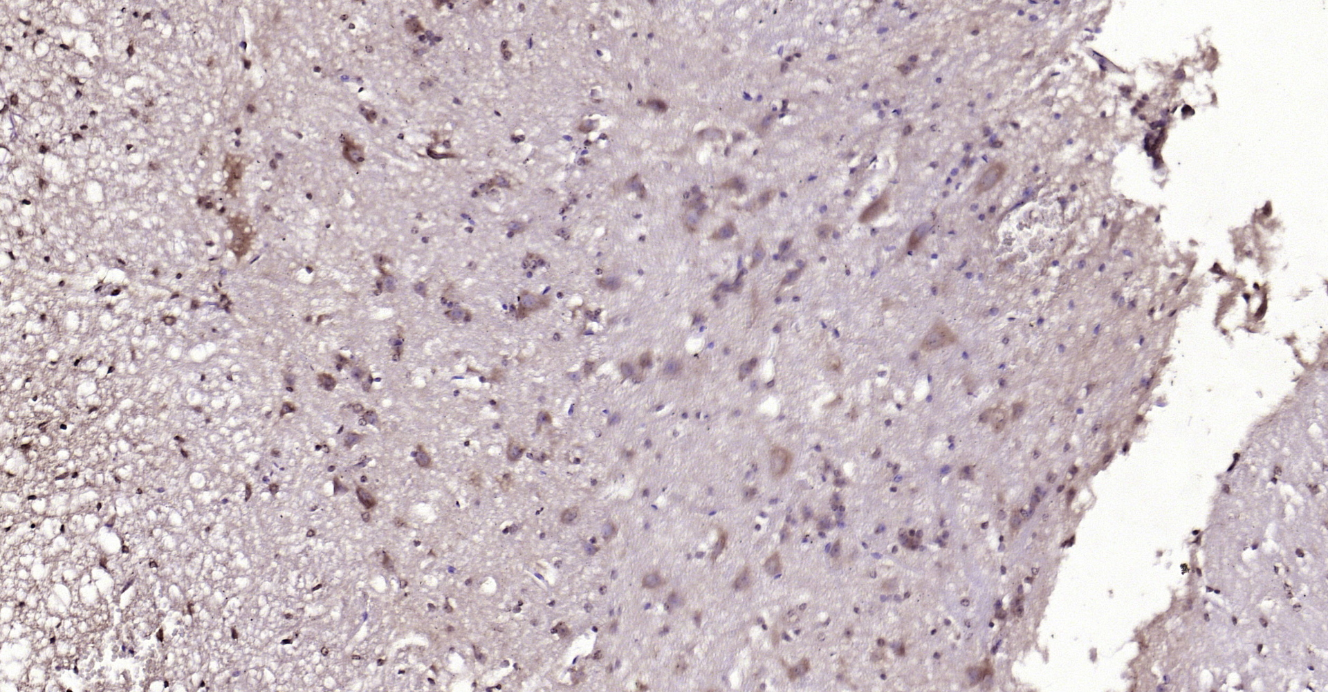Paraformaldehyde-fixed, paraffin embedded Mouse spinal cord; Antigen retrieval by boiling in sodium citrate buffer (pH6.0) for 15min; Block endogenous peroxidase by 3% hydrogen peroxide for 20 minutes; Blocking buffer (normal goat serum) at 37°C for 30min; Antibody incubation with GLUT12 Polyclonal Antibody, Unconjugated (bs-2540R) at 1:200 overnight at 4°C, DAB staining. Paraformaldehyde-fixed, paraffin embedded Mouse spinal cord; Antigen retrieval by boiling in sodium citrate buffer (pH6.0) for 15min; Block endogenous peroxidase by 3% hydrogen peroxide for 20 minutes; Blocking buffer (normal goat serum) at 37°C for 30min; Antibody incubation with GLUT12 Polyclonal Antibody, Unconjugated (bs-2540R) at 1:200 overnight at 4°C, DAB staining.