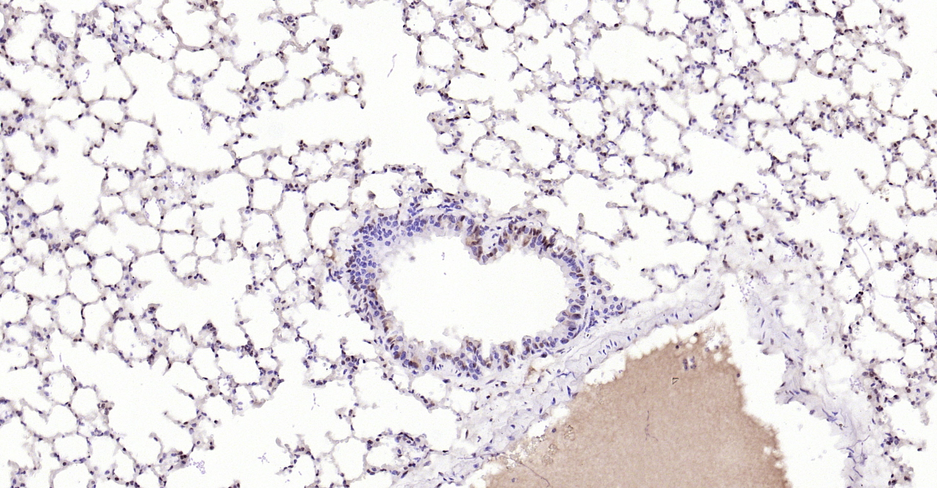 Paraformaldehyde-fixed, paraffin embedded Rat lung; Antigen retrieval by boiling in sodium citrate buffer (pH6.0) for 15min; Block endogenous peroxidase by 3% hydrogen peroxide for 20 minutes; Blocking buffer (normal goat serum) at 37°C for 30min; Antibody incubation with YB1(Ser102) Polyclonal Antibody, Unconjugated (bs-3477R) at 1:200 overnight at 4°C, DAB staining.