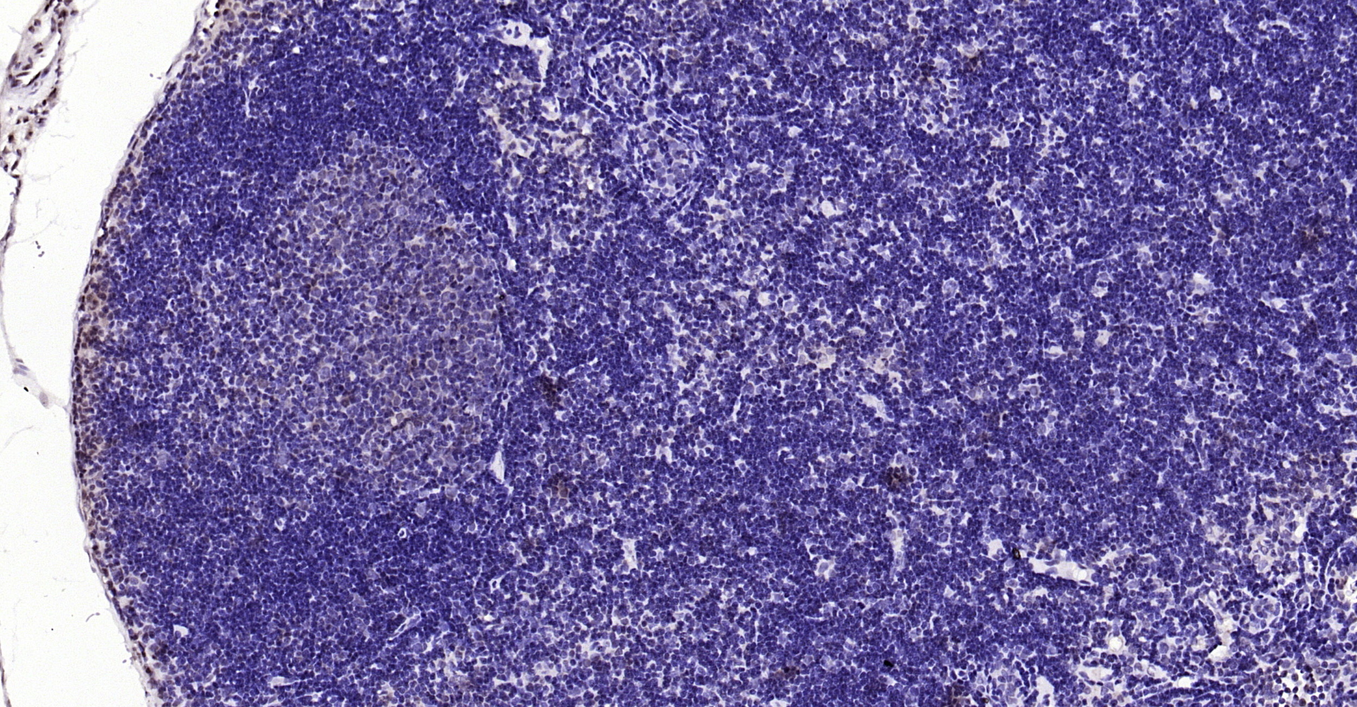 Paraformaldehyde-fixed, paraffin embedded Rat lymph node; Antigen retrieval by boiling in sodium citrate buffer (pH6.0) for 15min; Block endogenous peroxidase by 3% hydrogen peroxide for 20 minutes; Blocking buffer (normal goat serum) at 37°C for 30min; Antibody incubation with YB1(Ser102) Polyclonal Antibody, Unconjugated (bs-3477R) at 1:200 overnight at 4°C, DAB staining.