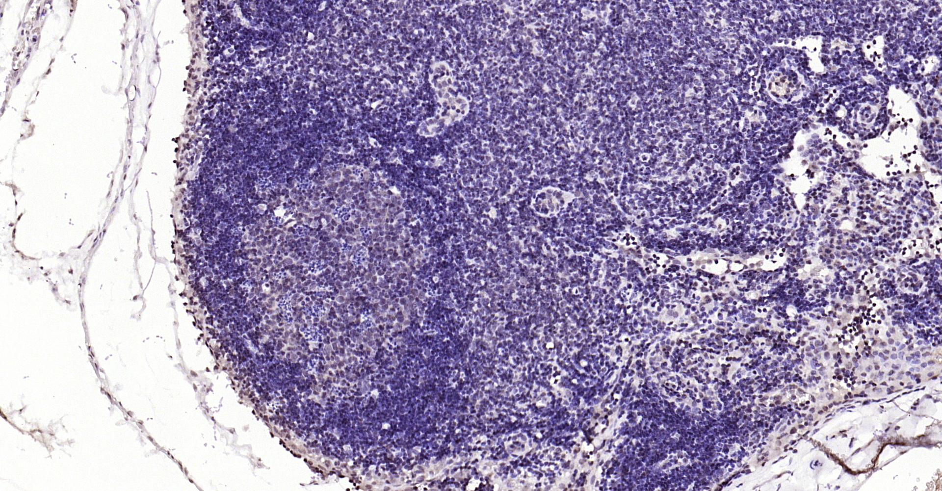 Paraformaldehyde-fixed, paraffin embedded Mouse lymph node; Antigen retrieval by boiling in sodium citrate buffer (pH6.0) for 15min; Block endogenous peroxidase by 3% hydrogen peroxide for 20 minutes; Blocking buffer (normal goat serum) at 37°C for 30min; Antibody incubation with YB1(Ser102) Polyclonal Antibody, Unconjugated (bs-3477R) at 1:200 overnight at 4°C, DAB staining.