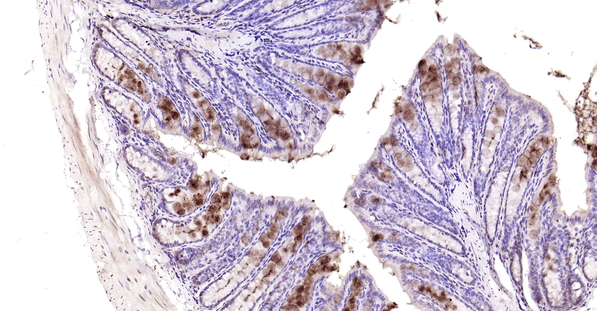 Paraformaldehyde-fixed, paraffin embedded Mouse colon; Antigen retrieval by boiling in sodium citrate buffer (pH6.0) for 15min; Block endogenous peroxidase by 3% hydrogen peroxide for 20 minutes; Blocking buffer (normal goat serum) at 37°C for 30min; Antibody incubation with YB1(Ser102) Polyclonal Antibody, Unconjugated (bs-3477R) at 1:200 overnight at 4°C, DAB staining.