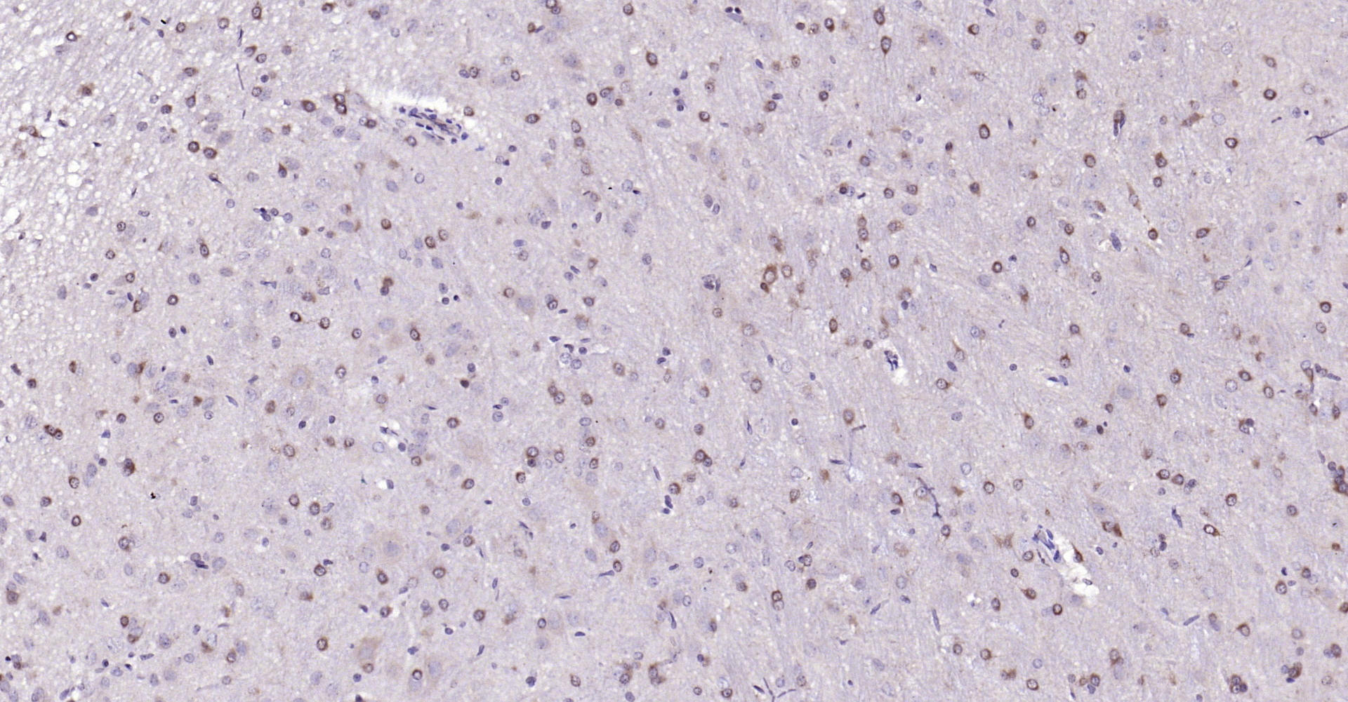 Paraformaldehyde-fixed, paraffin embedded Rat brain; Antigen retrieval by boiling in sodium citrate buffer (pH6.0) for 15min; Block endogenous peroxidase by 3% hydrogen peroxide for 20 minutes; Blocking buffer (normal goat serum) at 37°C for 30min; Antibody incubation with HMGCR (Ser872) Polyclonal Antibody, Unconjugated (bs-4063R) at 1:200 overnight at 4°C, DAB staining.
