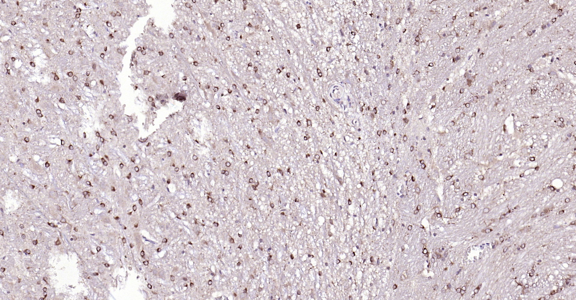 Paraformaldehyde-fixed, paraffin embedded Mouse brain; Antigen retrieval by boiling in sodium citrate buffer (pH6.0) for 15min; Block endogenous peroxidase by 3% hydrogen peroxide for 20 minutes; Blocking buffer (normal goat serum) at 37°C for 30min; Antibody incubation with HMGCR (Ser872) Polyclonal Antibody, Unconjugated (bs-4063R) at 1:200 overnight at 4°C, DAB staining.