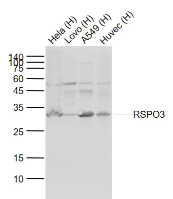 Lane 1: Human Hela cell lysates; Lane 2: Human Lovo cell lysates; Lane 3: Human A549 cell lysates; Lane 4: Human Huvec cell lysates probed with RSPO3 Polyclonal Antibody, Unconjugated (bs-18877R) at 1:1000 dilution and 4°C overnight incubation. Followed by conjugated secondary antibody incubation at 1:20000 for 60 min at 37˚C.
