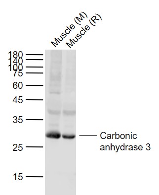 Lane 1: Mouse Muscle tissue lysates; Lane 2: Rat Muscle tissue lysates probed with Carbonic anhydrase 3 Polyclonal Antibody, Unconjugated (bs-24471R) at 1:1000 dilution and 4°C overnight incubation. Followed by conjugated secondary antibody incubation at 1:20000 for 60 min at 37˚C.