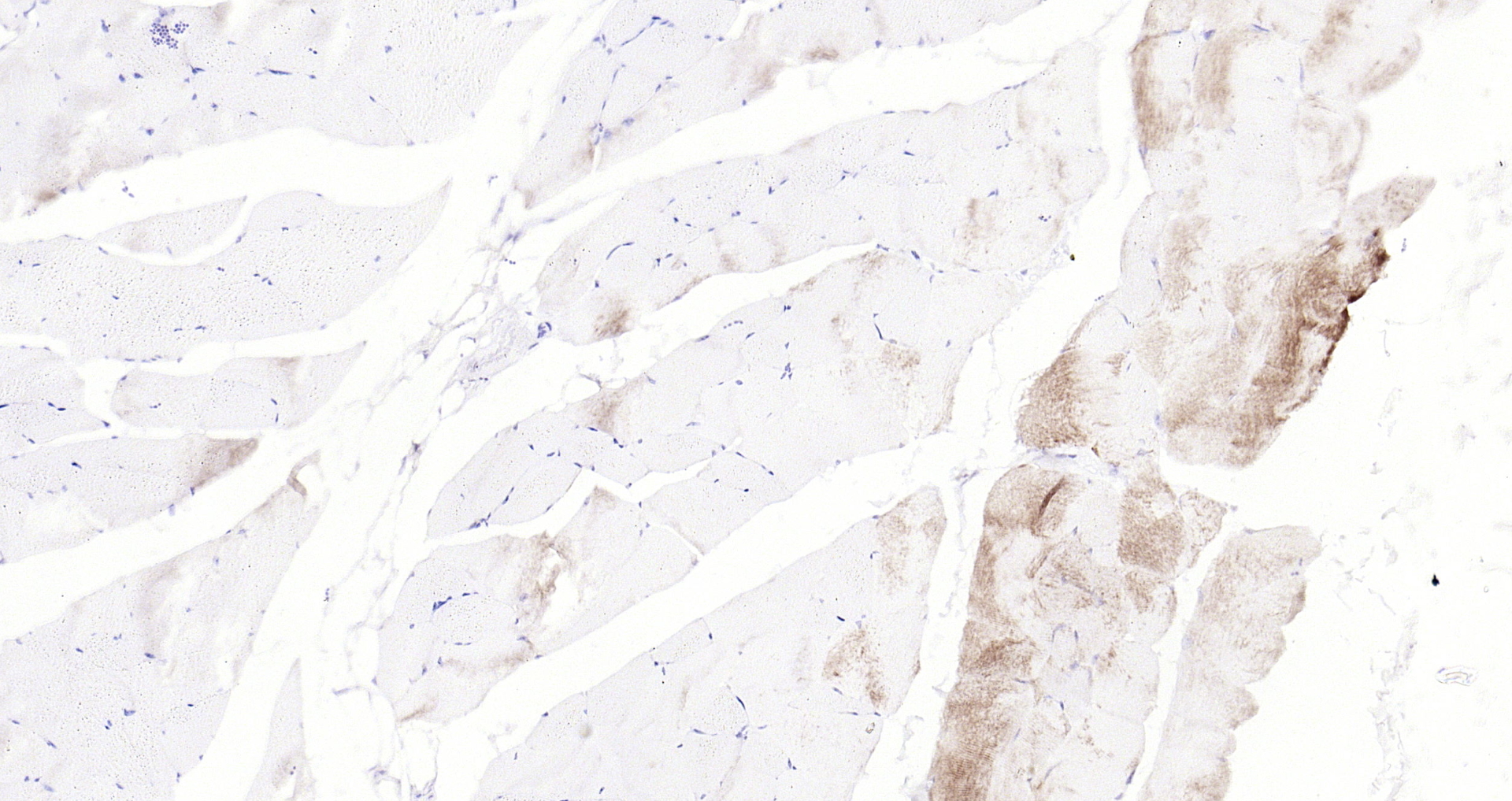 Paraformaldehyde-fixed, paraffin embedded Mouse muscle; Antigen retrieval by boiling in sodium citrate buffer (pH6.0) for 15min; Block endogenous peroxidase by 3% hydrogen peroxide for 20 minutes; Blocking buffer (normal goat serum) at 37°C for 30min; Antibody incubation with Glycogen synthase 1(S641) (10C1) Monoclonal Antibody, Unconjugated (bsm-52159R) at 1:200 overnight at 4°C, DAB staining.
