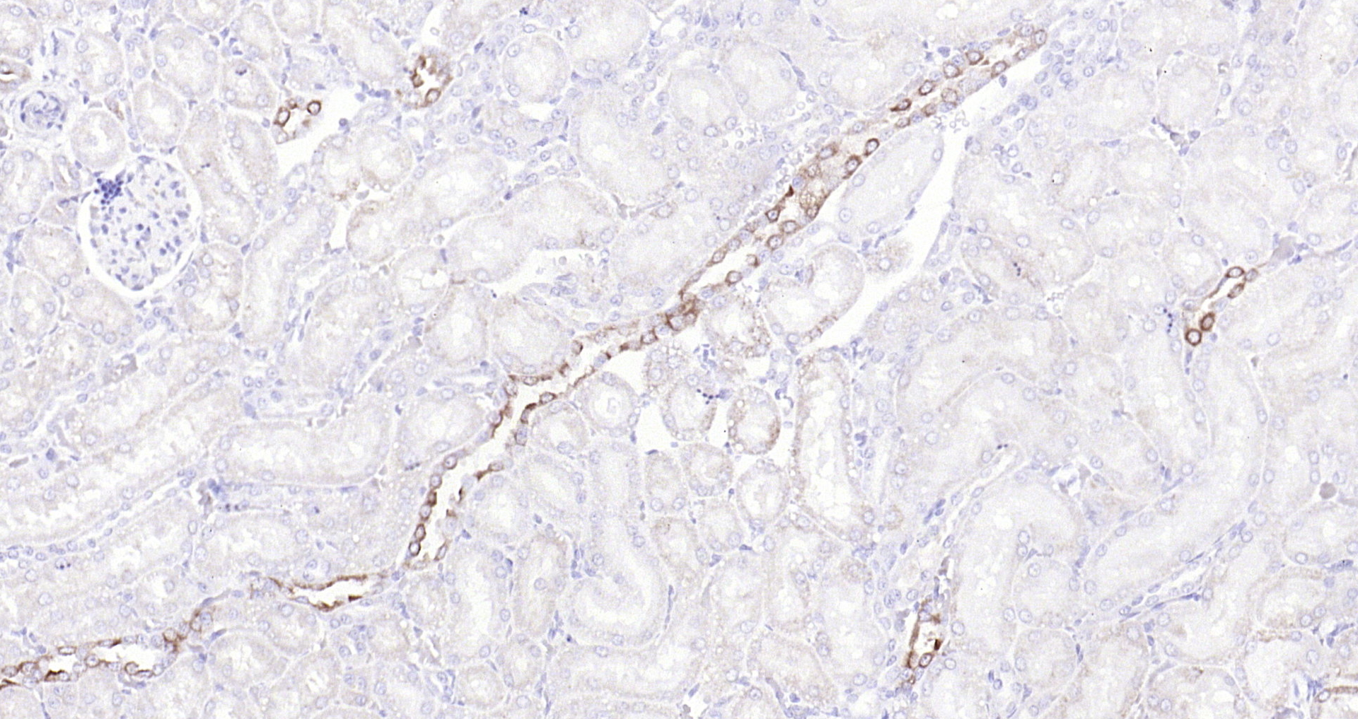 Paraformaldehyde-fixed, paraffin embedded Rat kidney; Antigen retrieval by boiling in sodium citrate buffer (pH6.0) for 15min; Block endogenous peroxidase by 3% hydrogen peroxide for 20 minutes; Blocking buffer (normal goat serum) at 37°C for 30min; Antibody incubation with Glycogen synthase 1(S641) (10C1) Monoclonal Antibody, Unconjugated (bsm-52159R) at 1:200 overnight at 4°C, DAB staining.