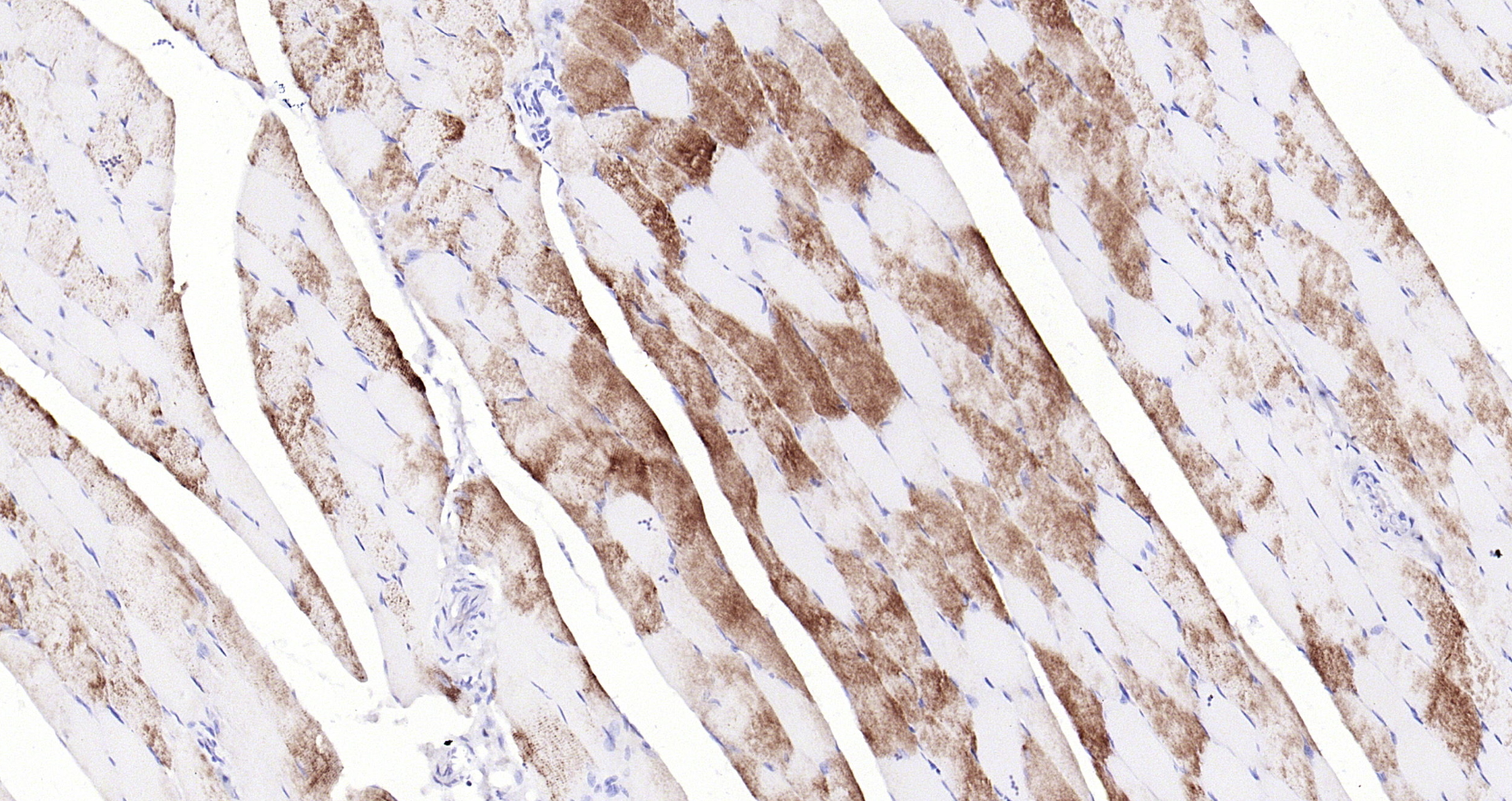Paraformaldehyde-fixed, paraffin embedded Rat muscle; Antigen retrieval by boiling in sodium citrate buffer (pH6.0) for 15min; Block endogenous peroxidase by 3% hydrogen peroxide for 20 minutes; Blocking buffer (normal goat serum) at 37°C for 30min; Antibody incubation with Glycogen synthase 1(S641) (10C1) Monoclonal Antibody, Unconjugated (bsm-52159R) at 1:200 overnight at 4°C, DAB staining.