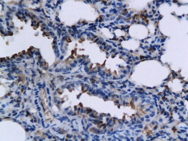 Formalin-fixed and paraffin embedded mouse lung labeled with Rabbit Anti-TNFSF15 Polyclonal Antibody, Unconjugated (bs-5092R) followed by conjugation to the secondary antibody and DAB staining