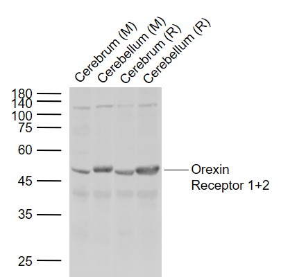Lane 1: Mouse Cerebrum tissue lysates; Lane 2: Mouse Cerebellum tissue lysates; Lane 3: Rat Cerebrum tissue lysates; Lane 4: Rat Cerebellum tissue lysates probed with Orexin receptor 1+2 Polyclonal Antibody, Unconjugated (bs-1095R) at 1:1000 dilution and 4°C overnight incubation. Followed by conjugated secondary antibody incubation at 1:20000 for 60 min at 37˚C.