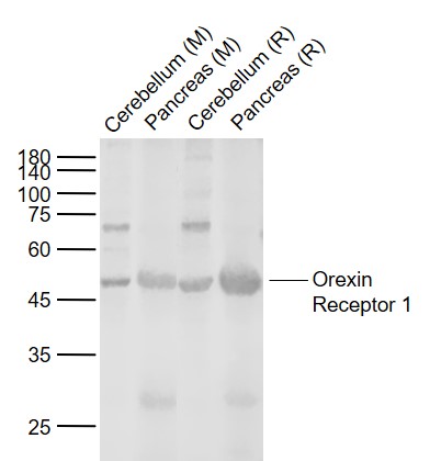 Lane 1: Mouse Cerebellum tissue lysates; Lane 2: Mouse Pancreas tissue lysates; Lane 3: Rat Cerebellum tissue lysates; Lane 4: Rat Pancreas tissue lysates probed with Orexin Receptor 1 Polyclonal Antibody, Unconjugated (bs-18029R) at 1:1000 dilution and 4°C overnight incubation. Followed by conjugated secondary antibody incubation at 1:20000 for 60 min at 37˚C.
