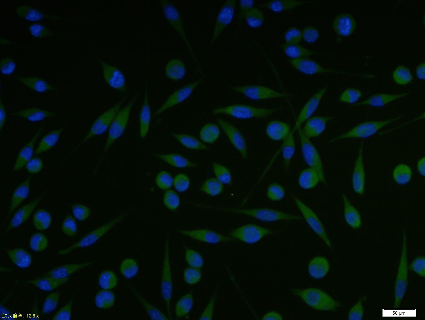 A431 cell; 4% Paraformaldehyde-fixed; Triton X-100 at room temperature for 20 min; Blocking buffer (normal goat serum, C-0005) at 37°C for 20 min; Antibody incubation with (Vitamin D Receptor) polyclonal Antibody, Unconjugated (bs-2987R) 1:100, 90 minutes at 37°C; followed by a conjugated Goat Anti-Rabbit IgG antibody at 37°C for 90 minutes, DAPI (blue, C02-04002) was used to stain the cell nuclei.