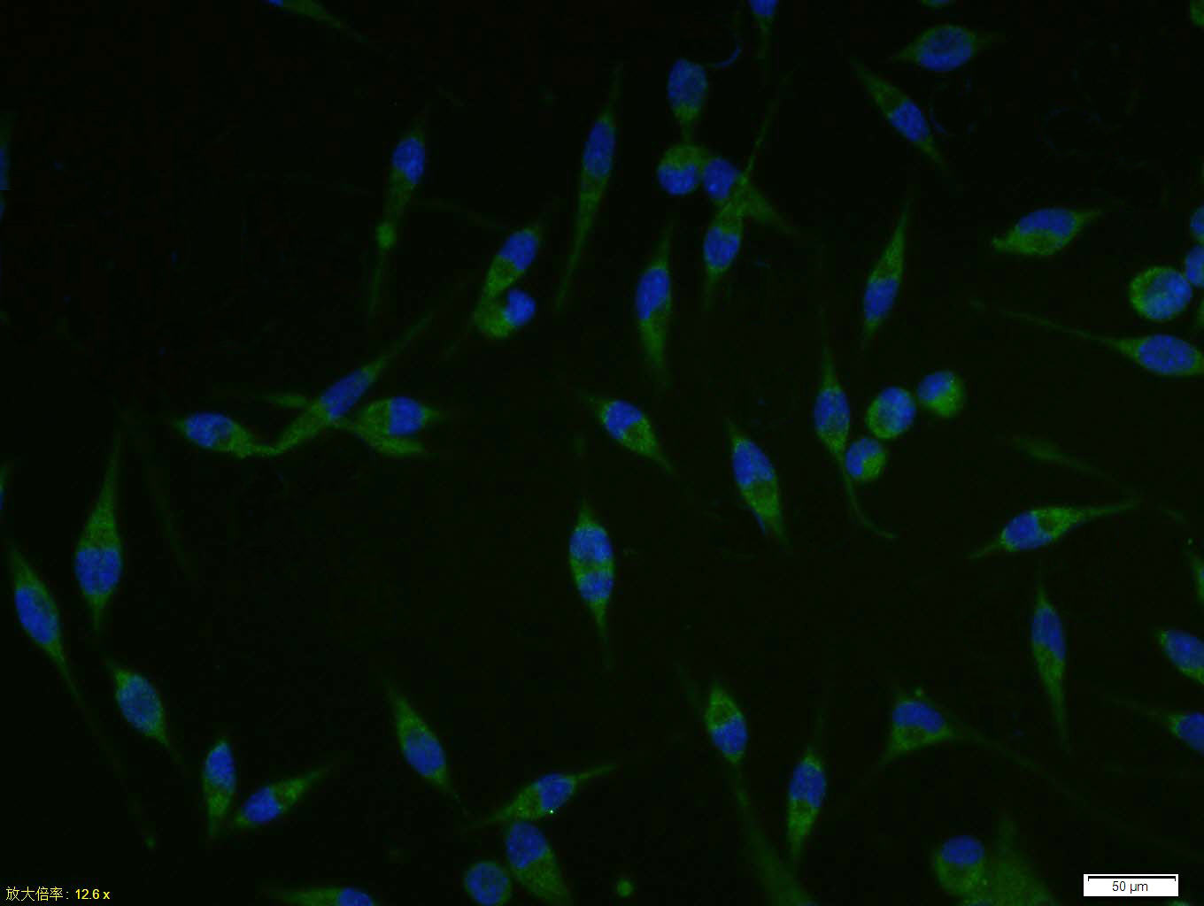 A431 cell; 4% Paraformaldehyde-fixed; Triton X-100 at room temperature for 20 min; Blocking buffer (normal goat serum, C-0005) at 37°C for 20 min; Antibody incubation with (SCD1) polyclonal Antibody, Unconjugated (bs-3787R) 1:100, 90 minutes at 37°C; followed by a conjugated Goat Anti-Rabbit IgG antibody at 37°C for 90 minutes, DAPI (blue, C02-04002) was used to stain the cell nuclei.
