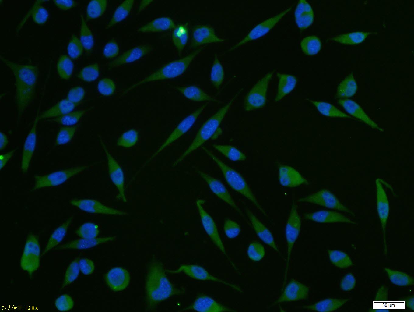 A431 cell; 4% Paraformaldehyde-fixed; Triton X-100 at room temperature for 20 min; Blocking buffer (normal goat serum, C-0005) at 37°C for 20 min; Antibody incubation with (CARD14) polyclonal Antibody, Unconjugated (bs-7083R) 1:100, 90 minutes at 37°C; followed by a conjugated Goat Anti-Rabbit IgG antibody at 37°C for 90 minutes, DAPI (blue, C02-04002) was used to stain the cell nuclei.