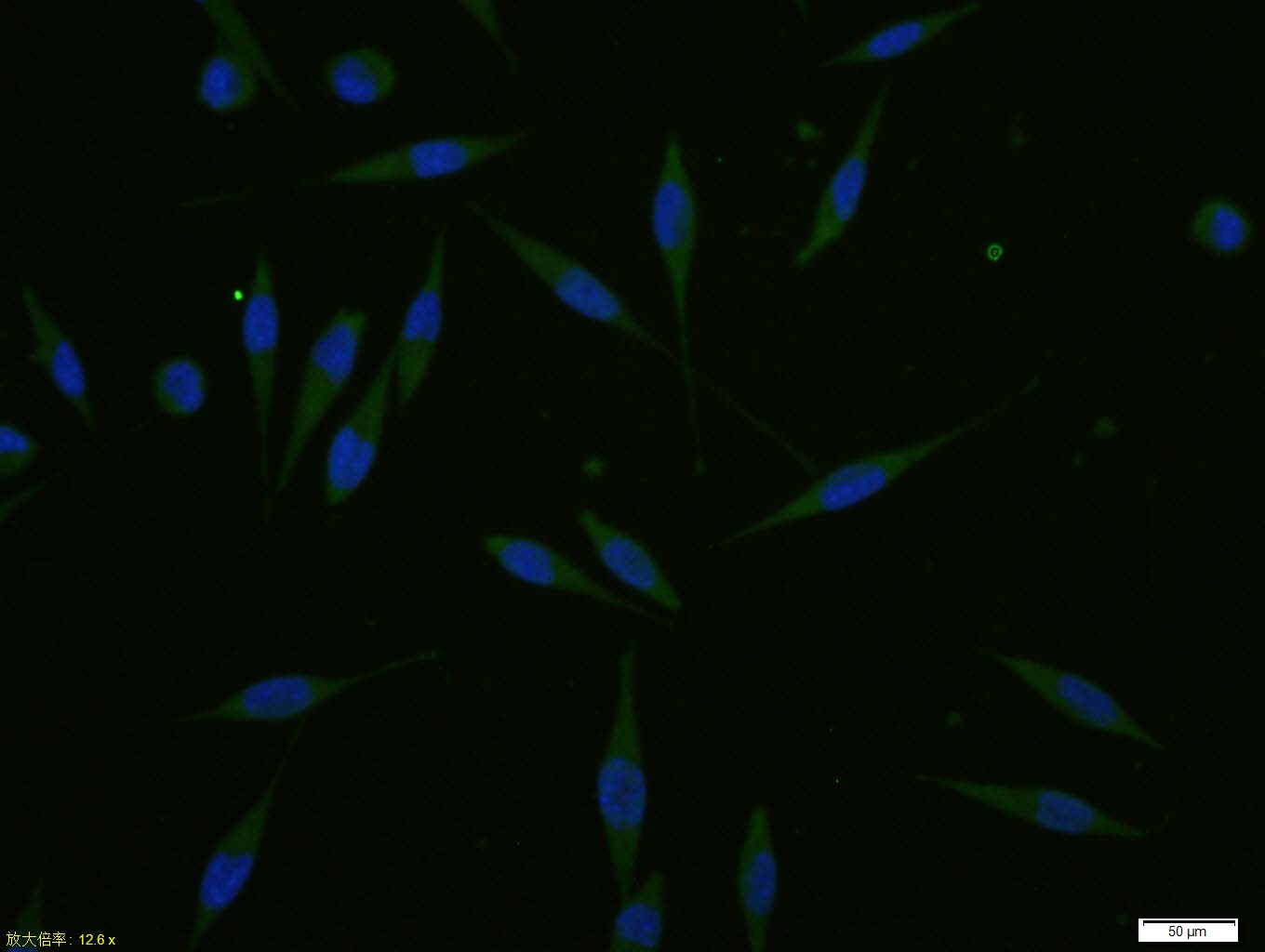 A431 cell; 4% Paraformaldehyde-fixed; Triton X-100 at room temperature for 20 min; Blocking buffer (normal goat serum, C-0005) at 37°C for 20 min; Antibody incubation with (p53 (FL-393)) polyclonal Antibody, Unconjugated (bs-8687R) 1:100, 90 minutes at 37°C; followed by a conjugated Goat Anti-Rabbit IgG antibody at 37°C for 90 minutes, DAPI (blue, C02-04002) was used to stain the cell nuclei.