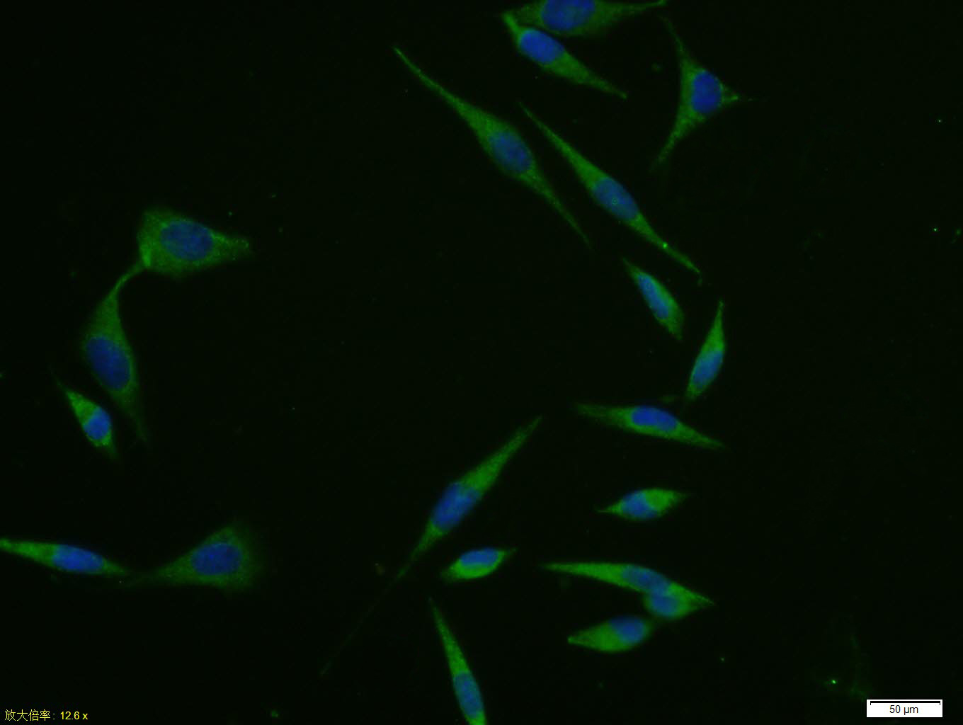 A431 cell; 4% Paraformaldehyde-fixed; Triton X-100 at room temperature for 20 min; Blocking buffer (normal goat serum, C-0005) at 37°C for 20 min; Antibody incubation with (Egr1) polyclonal Antibody, Unconjugated (bs-1076R) 1:100, 90 minutes at 37°C; followed by a conjugated Goat Anti-Rabbit IgG antibody at 37°C for 90 minutes, DAPI (blue, C02-04002) was used to stain the cell nuclei.