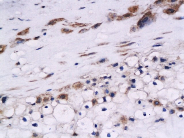 Formalin-fixed and paraffin embedded human placenta labeled with Anti-Cystatin B Polyclonal Antibody, Unconjugated (bs-5158R) at 1:200 followed by conjugation to the secondary antibody and DAB staining