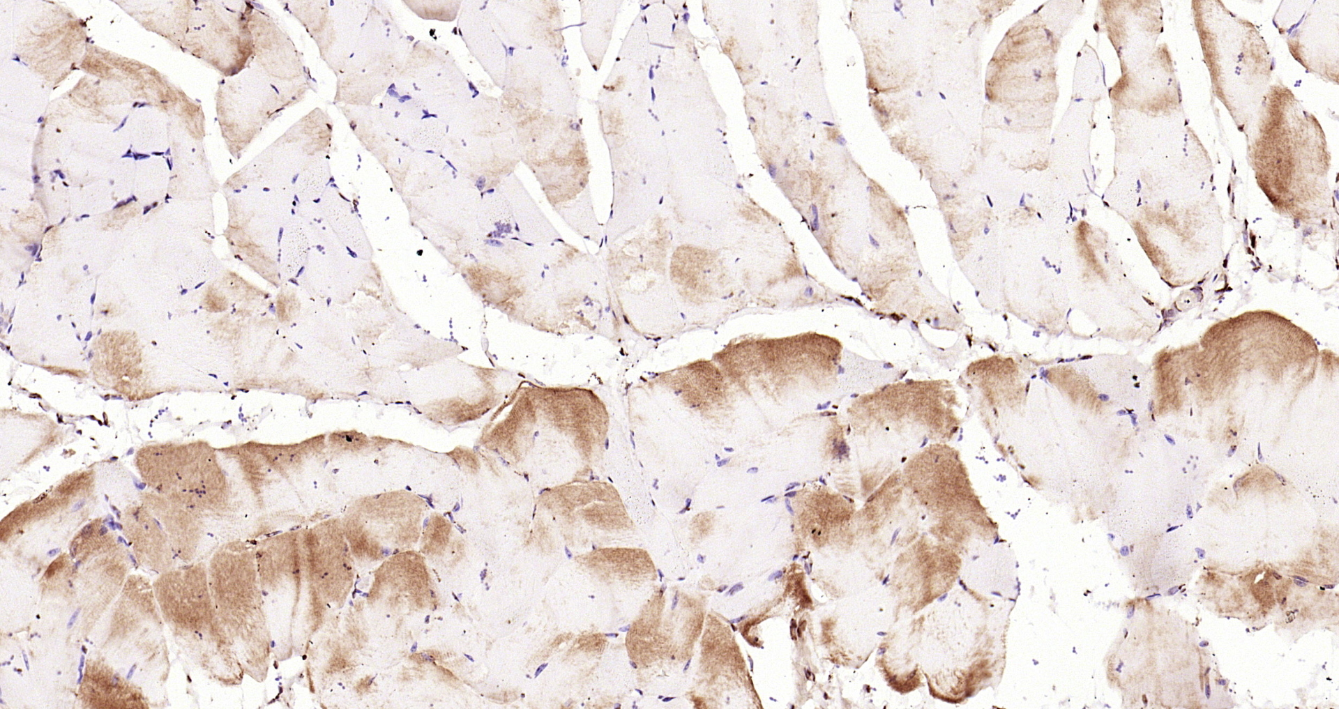 Paraformaldehyde-fixed, paraffin embedded Mouse muscle; Antigen retrieval by boiling in sodium citrate buffer (pH6.0) for 15min; Block endogenous peroxidase by 3% hydrogen peroxide for 20 minutes; Blocking buffer (normal goat serum) at 37°C for 30min; Antibody incubation with CACNA1S Polyclonal Antibody, Unconjugated (bs-9925R) at 1:200 overnight at 4°C, DAB staining.