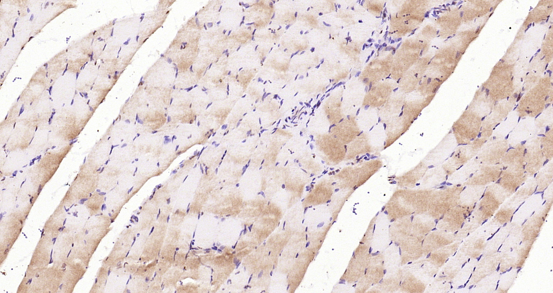 Paraformaldehyde-fixed, paraffin embedded Rat muscle; Antigen retrieval by boiling in sodium citrate buffer (pH6.0) for 15min; Block endogenous peroxidase by 3% hydrogen peroxide for 20 minutes; Blocking buffer (normal goat serum) at 37°C for 30min; Antibody incubation with CACNA1S Polyclonal Antibody, Unconjugated (bs-9925R) at 1:200 overnight at 4°C, DAB staining. Paraformaldehyde-fixed, paraffin embedded Rat muscle; Antigen retrieval by boiling in sodium citrate buffer (pH6.0) for 15min; Block endogenous peroxidase by 3% hydrogen peroxide for 20 minutes; Blocking buffer (normal goat serum) at 37°C for 30min; Antibody incubation with CACNA1S Polyclonal Antibody, Unconjugated (bs-9925R) at 1:200 overnight at 4°C, DAB staining.