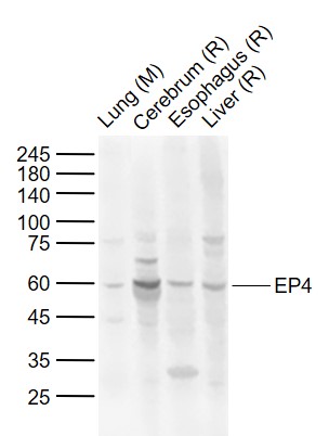 Lane 1: Mouse Lung tissue lysates; Lane 2: Rat Cerebrum tissue lysates; Lane 3: Rat Esophagus tissue lysates; Lane 4: Rat Liver tissue lysates probed with EP4 Polyclonal Antibody, Unconjugated (bs-8538R) at 1:1000 dilution and 4°C overnight incubation. Followed by conjugated secondary antibody incubation at 1:20000 for 60 min at 37˚C.