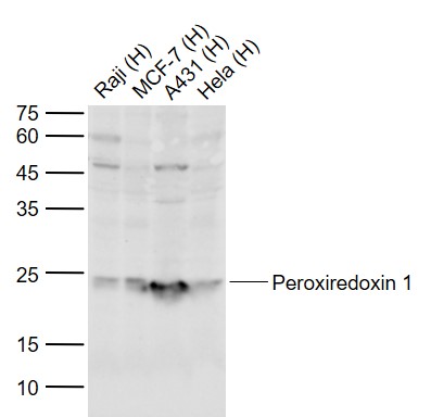 Lane 1: Human Raji cell lysates; Lane 2: Human Hela cell lysates; Lane 3: Human A431 cell lysates; Lane 4: Human Hela cell lysates probed with Peroxiredoxin 1 Polyclonal Antibody, Unconjugated (bs-3875R) at 1:1000 dilution and 4°C overnight incubation. Followed by conjugated secondary antibody incubation at 1:20000 for 60 min at 37˚C.