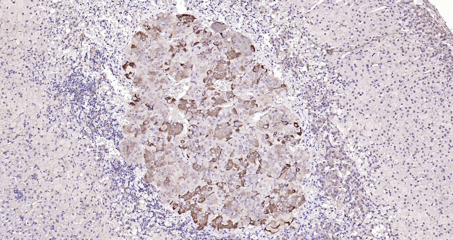 Paraformaldehyde-fixed, paraffin embedded Mouse adrenal gland; Antigen retrieval by boiling in sodium citrate buffer (pH6.0) for 15min; Block endogenous peroxidase by 3% hydrogen peroxide for 20 minutes; Blocking buffer (normal goat serum) at 37°C for 30min; Antibody incubation with Rarres2 Polyclonal Antibody, Unconjugated (bs-1501R) at 1:200 overnight at 4°C, DAB staining.