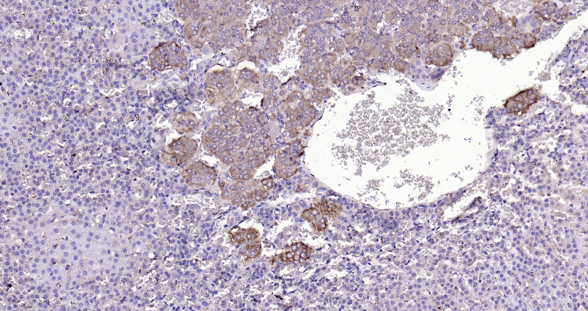 Paraformaldehyde-fixed, paraffin embedded Rat adrenal gland; Antigen retrieval by boiling in sodium citrate buffer (pH6.0) for 15min; Block endogenous peroxidase by 3% hydrogen peroxide for 20 minutes; Blocking buffer (normal goat serum) at 37°C for 30min; Antibody incubation with Rarres2 Polyclonal Antibody, Unconjugated (bs-1501R) at 1:200 overnight at 4°C, DAB staining.