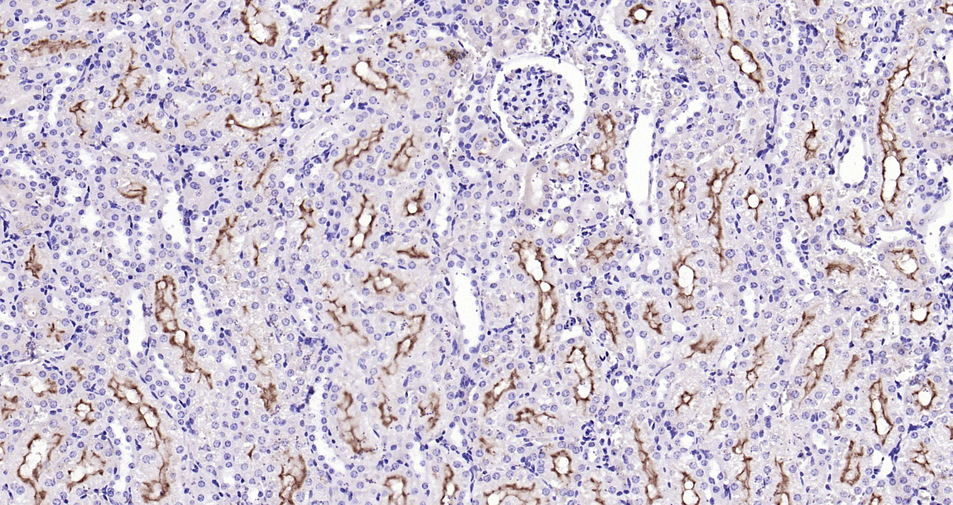 Paraformaldehyde-fixed, paraffin embedded Mouse kidney; Antigen retrieval by boiling in sodium citrate buffer (pH6.0) for 15min; Block endogenous peroxidase by 3% hydrogen peroxide for 20 minutes; Blocking buffer (normal goat serum) at 37°C for 30min; Antibody incubation with Transmembrane Protein 30A Polyclonal Antibody, Unconjugated (bs-16576R) at 1:200 overnight at 4°C, DAB staining.