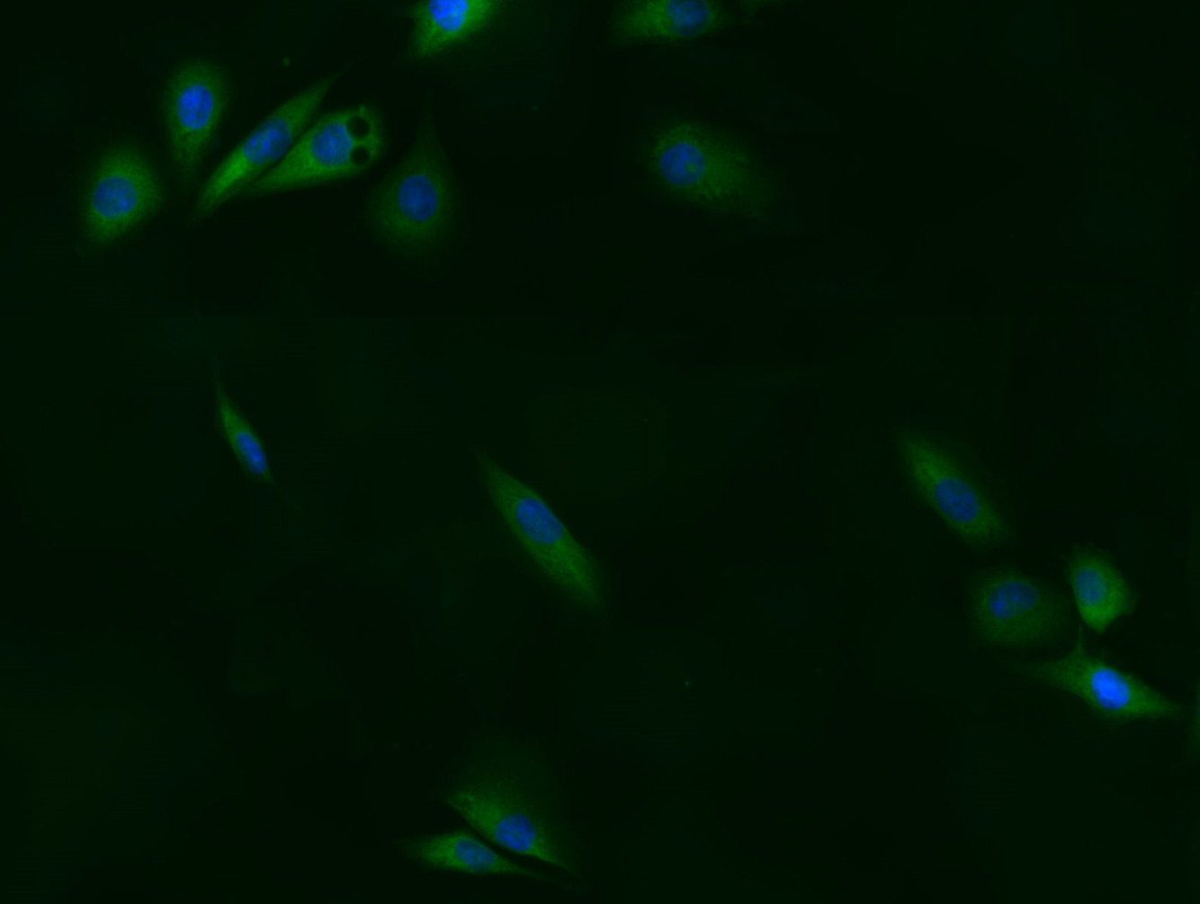HUVEC cell; 4% Paraformaldehyde-fixed; Triton X-100 at room temperature for 20 min; Blocking buffer (normal goat serum, C-0005) at 37°C for 20 min; Antibody incubation with (FAK) polyclonal Antibody, Unconjugated (bs-1340R) 1:100, 90 minutes at 37°C; followed by a conjugated Goat Anti-Rabbit IgG antibody at 37°C for 90 minutes, DAPI (blue, C02-04002) was used to stain the cell nuclei.