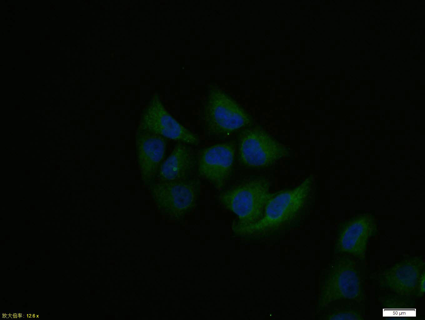 Hela cell; 4% Paraformaldehyde-fixed; Triton X-100 at room temperature for 20 min; Blocking buffer (normal goat serum, C-0005) at 37°C for 20 min; Antibody incubation with (LPA2) polyclonal Antibody, Unconjugated (bs-10368R) 1:100, 90 minutes at 37°C; followed by a conjugated Goat Anti-Rabbit IgG antibody at 37°C for 90 minutes, DAPI (blue, C02-04002) was used to stain the cell nuclei.