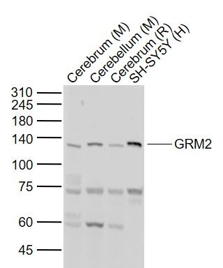 Lane 1: Mouse Cerebrum tissue lysates; Lane 2: Mouse Cerebellum tissue lysates; Lane 3: Rat Cerebrum tissue lysates; Lane 4: Human SH-SY5Y cell lysates probed with GRM2 /Metabotropic glutamate receptor 2 Polyclonal Antibody, Unconjugated (bs-1161R) at 1:1000 dilution and 4°C overnight incubation. Followed by conjugated secondary antibody incubation at 1:20000 for 60 min at 37˚C.