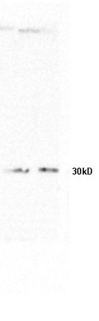 L1 and L2 rat lung lysates probed with Anti-phospho-MEK1/MAP2K1 (Thr386) Polyclonal Antibody, Unconjugated (bs-5413R) at 1:1000 in 4˚C. Followed by conjugation to secondary antibody (bs-0295G-HRP) at 1:3000 90min in 37˚C. Predicted band 42kD. Observed band size: 30kD