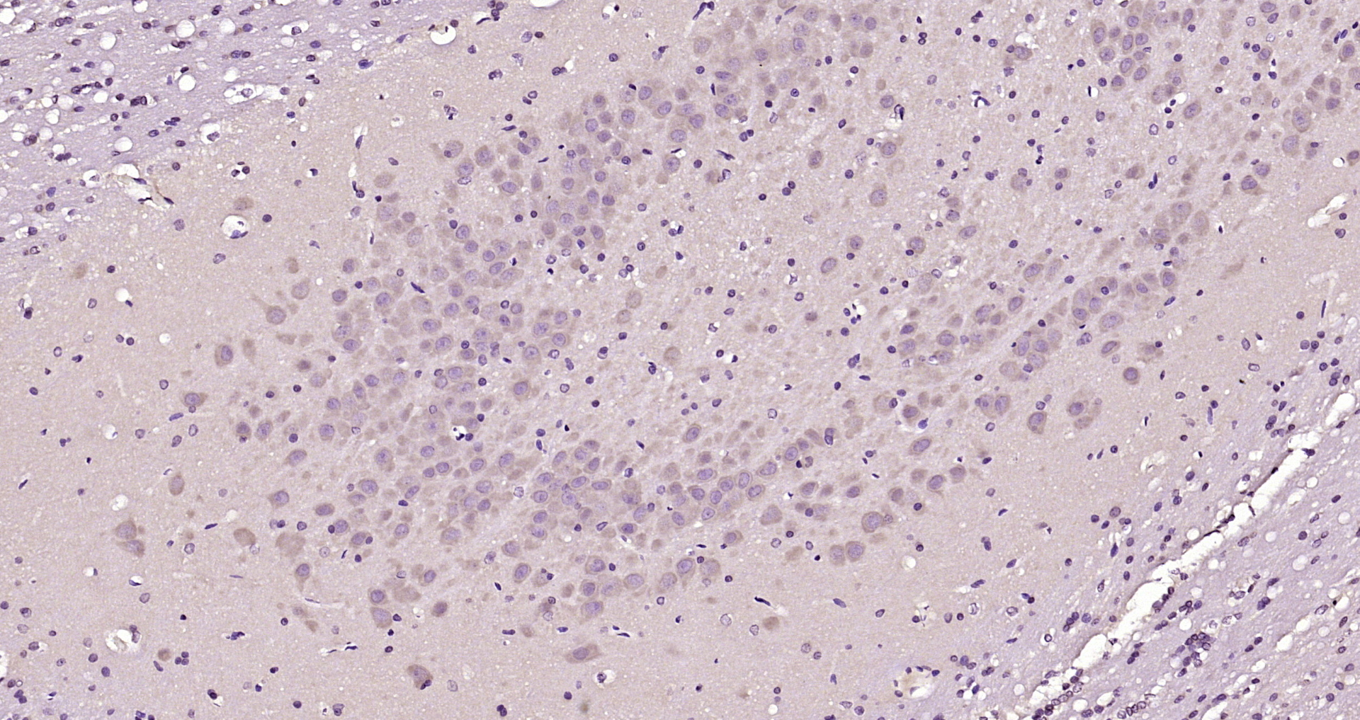 Paraformaldehyde-fixed, paraffin embedded Rat brain; Antigen retrieval by boiling in sodium citrate buffer (pH6.0) for 15min; Block endogenous peroxidase by 3% hydrogen peroxide for 20 minutes; Blocking buffer (normal goat serum) at 37°C for 30min; Antibody incubation with EDG8 Polyclonal Antibody, Unconjugated (bs-11457R) at 1:200 overnight at 4°C, DAB staining.