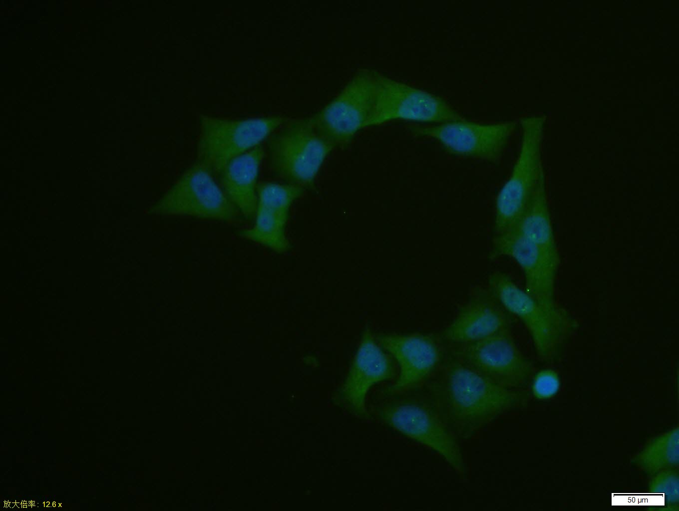 Hela cell; 4% Paraformaldehyde-fixed; Triton X-100 at room temperature for 20 min; Blocking buffer (normal goat serum, C-0005) at 37°C for 20 min; Antibody incubation with (GLK) polyclonal Antibody, Unconjugated (bs-1796R) 1:100, 90 minutes at 37°C; followed by a conjugated Goat Anti-Rabbit IgG antibody at 37°C for 90 minutes, DAPI (blue, C02-04002) was used to stain the cell nuclei.