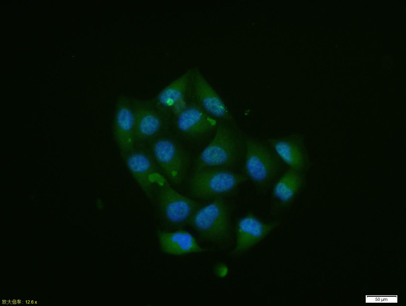 Hela cell; 4% Paraformaldehyde-fixed; Triton X-100 at room temperature for 20 min; Blocking buffer (normal goat serum, C-0005) at 37°C for 20 min; Antibody incubation with (Phospho-Smad2 (Ser465 + Ser467) ) polyclonal Antibody, Unconjugated (bs-3419R) 1:100, 90 minutes at 37°C; followed by a conjugated Goat Anti-Rabbit IgG antibody at 37°C for 90 minutes, DAPI (blue, C02-04002) was used to stain the cell nuclei.