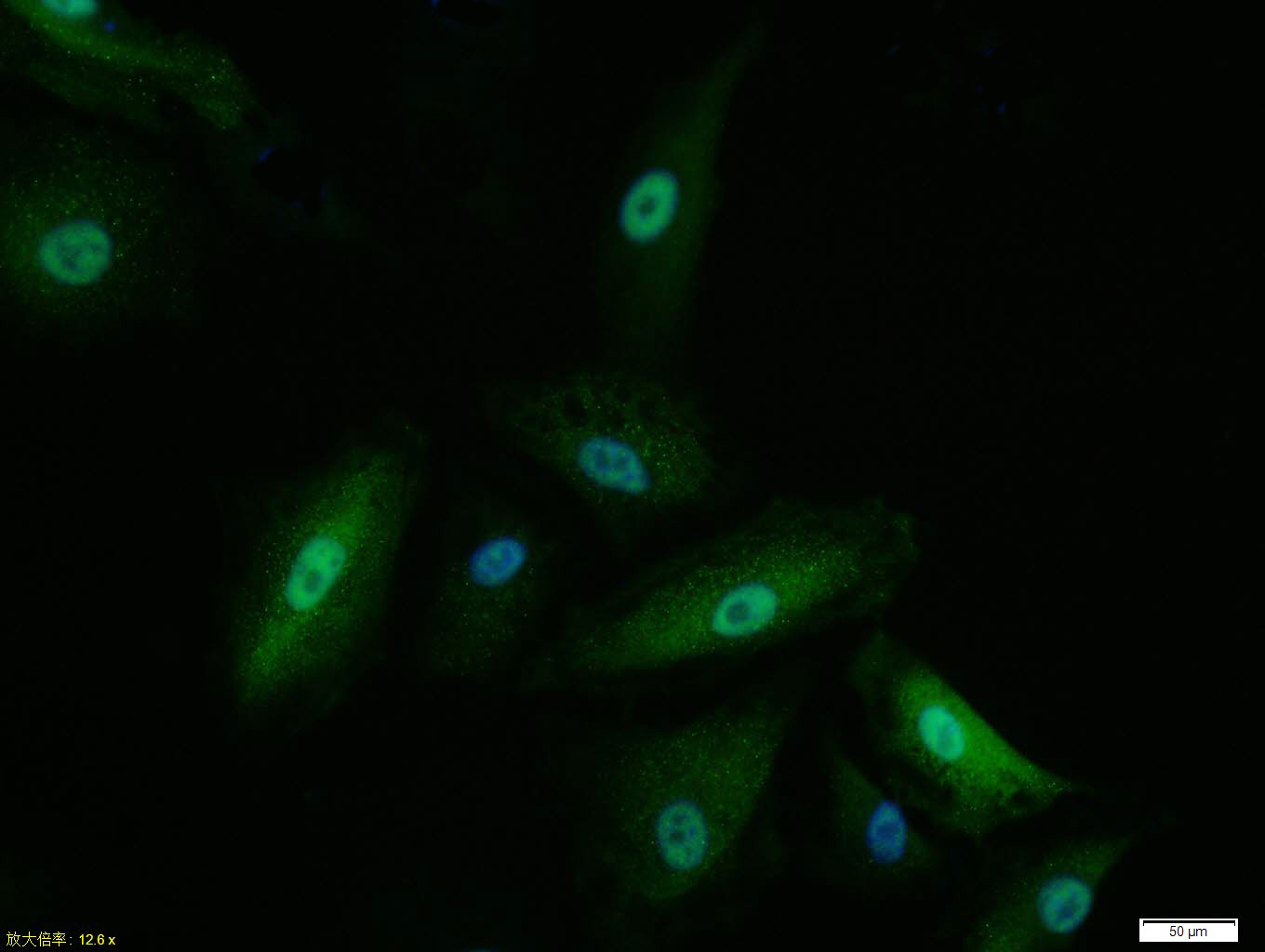 A549 cell; 4% Paraformaldehyde-fixed; Triton X-100 at room temperature for 20 min; Blocking buffer (normal goat serum, C-0005) at 37°C for 20 min; Antibody incubation with (Mad2L1) monoclonal Antibody, Unconjugated (bsm-54219R) 1:100, 90 minutes at 37°C; followed by a conjugated Goat Anti-Rabbit IgG antibody at 37°C for 90 minutes, DAPI (blue, C02-04002) was used to stain the cell nuclei.