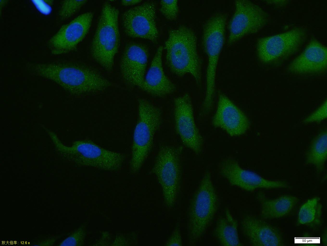 U2OS cell; 4% Paraformaldehyde-fixed; Triton X-100 at room temperature for 20 min; Blocking buffer (normal goat serum, C-0005) at 37°C for 20 min; Antibody incubation with (FoxP3) polyclonal Antibody, Unconjugated (bs-10211R) 1:100, 90 minutes at 37°C; followed by a conjugated Goat Anti-Rabbit IgG antibody at 37°C for 90 minutes, DAPI (blue, C02-04002) was used to stain the cell nuclei.