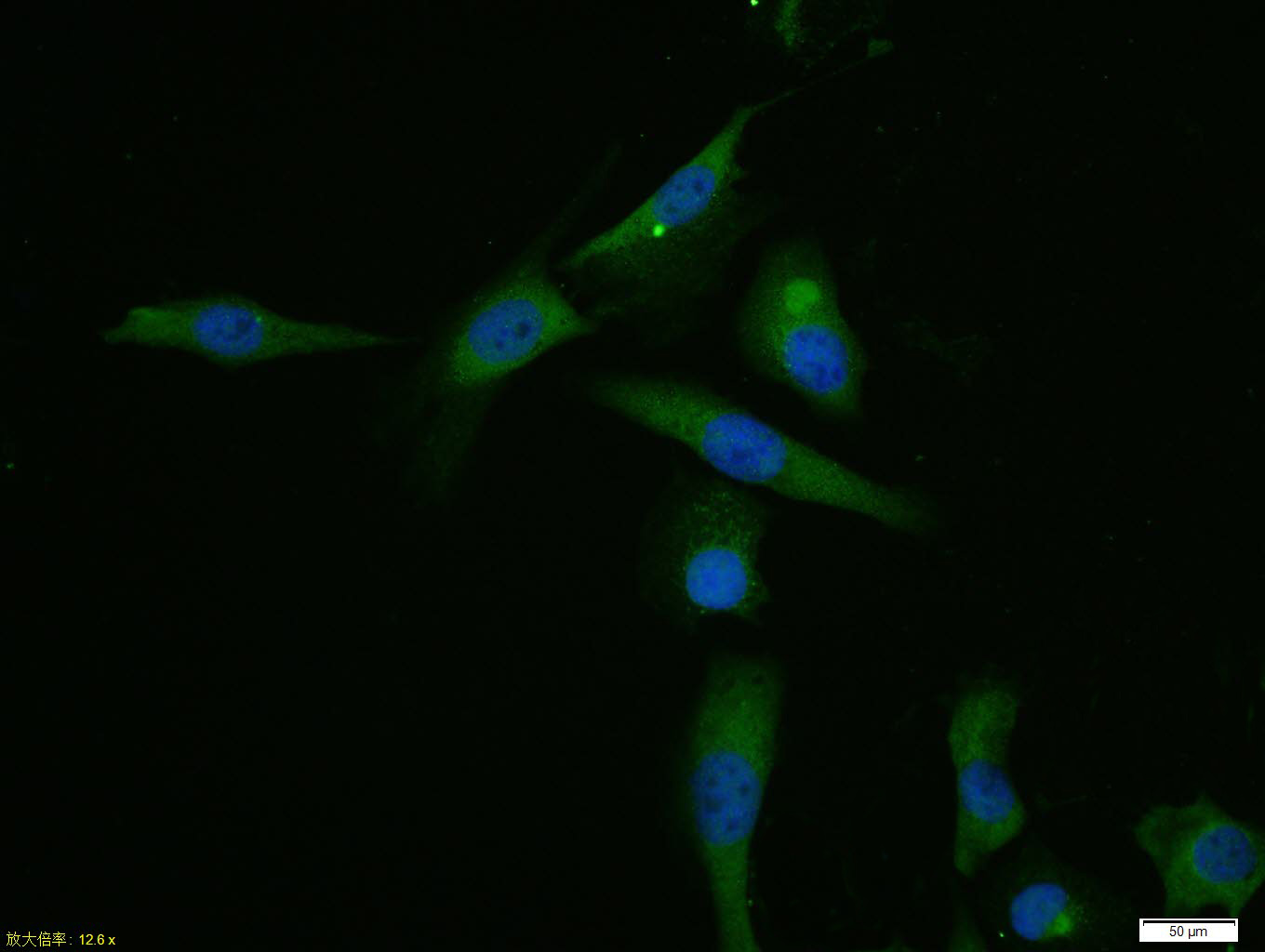 U2OS cell; 4% Paraformaldehyde-fixed; Triton X-100 at room temperature for 20 min; Blocking buffer (normal goat serum, C-0005) at 37°C for 20 min; Antibody incubation with (HSP90 beta) polyclonal Antibody, Unconjugated (bs-0135R) 1:100, 90 minutes at 37°C; followed by a conjugated Goat Anti-Rabbit IgG antibody at 37°C for 90 minutes, DAPI (blue, C02-04002) was used to stain the cell nuclei.