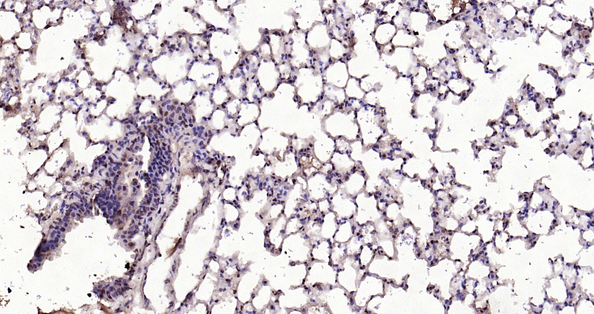 Paraformaldehyde-fixed, paraffin embedded Mouse lung; Antigen retrieval by boiling in sodium citrate buffer (pH6.0) for 15min; Block endogenous peroxidase by 3% hydrogen peroxide for 20 minutes; Blocking buffer (normal goat serum) at 37°C for 30min; Antibody incubation with IL-33 Polyclonal Antibody, Unconjugated (bs-2633R) at 1:200 overnight at 4°C, DAB staining.