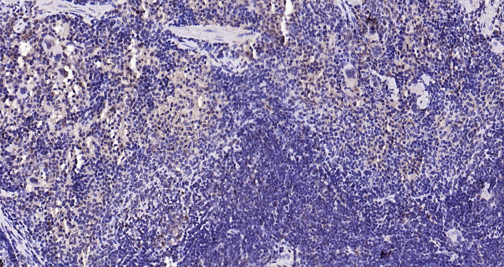 Paraformaldehyde-fixed, paraffin embedded Mouse spleen; Antigen retrieval by boiling in sodium citrate buffer (pH6.0) for 15min; Block endogenous peroxidase by 3% hydrogen peroxide for 20 minutes; Blocking buffer (normal goat serum) at 37°C for 30min; Antibody incubation with IL-33 Polyclonal Antibody, Unconjugated (bs-2633R) at 1:200 overnight at 4°C, DAB staining.