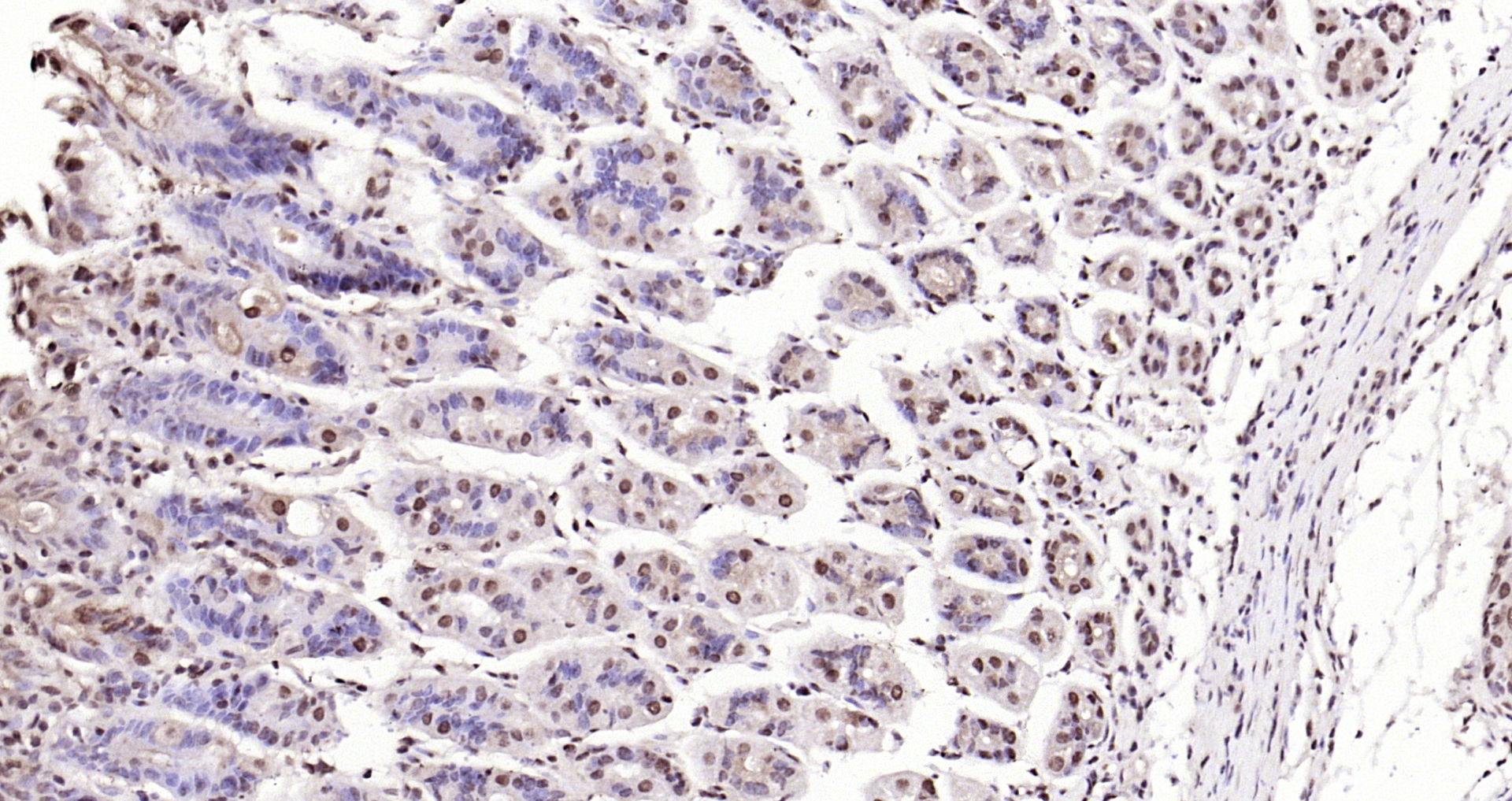 Paraformaldehyde-fixed, paraffin embedded Mouse stomach; Antigen retrieval by boiling in sodium citrate buffer (pH6.0) for 15min; Block endogenous peroxidase by 3% hydrogen peroxide for 20 minutes; Blocking buffer (normal goat serum) at 37°C for 30min; Antibody incubation with IL-33 Polyclonal Antibody, Unconjugated (bs-2633R) at 1:200 overnight at 4°C, DAB staining.