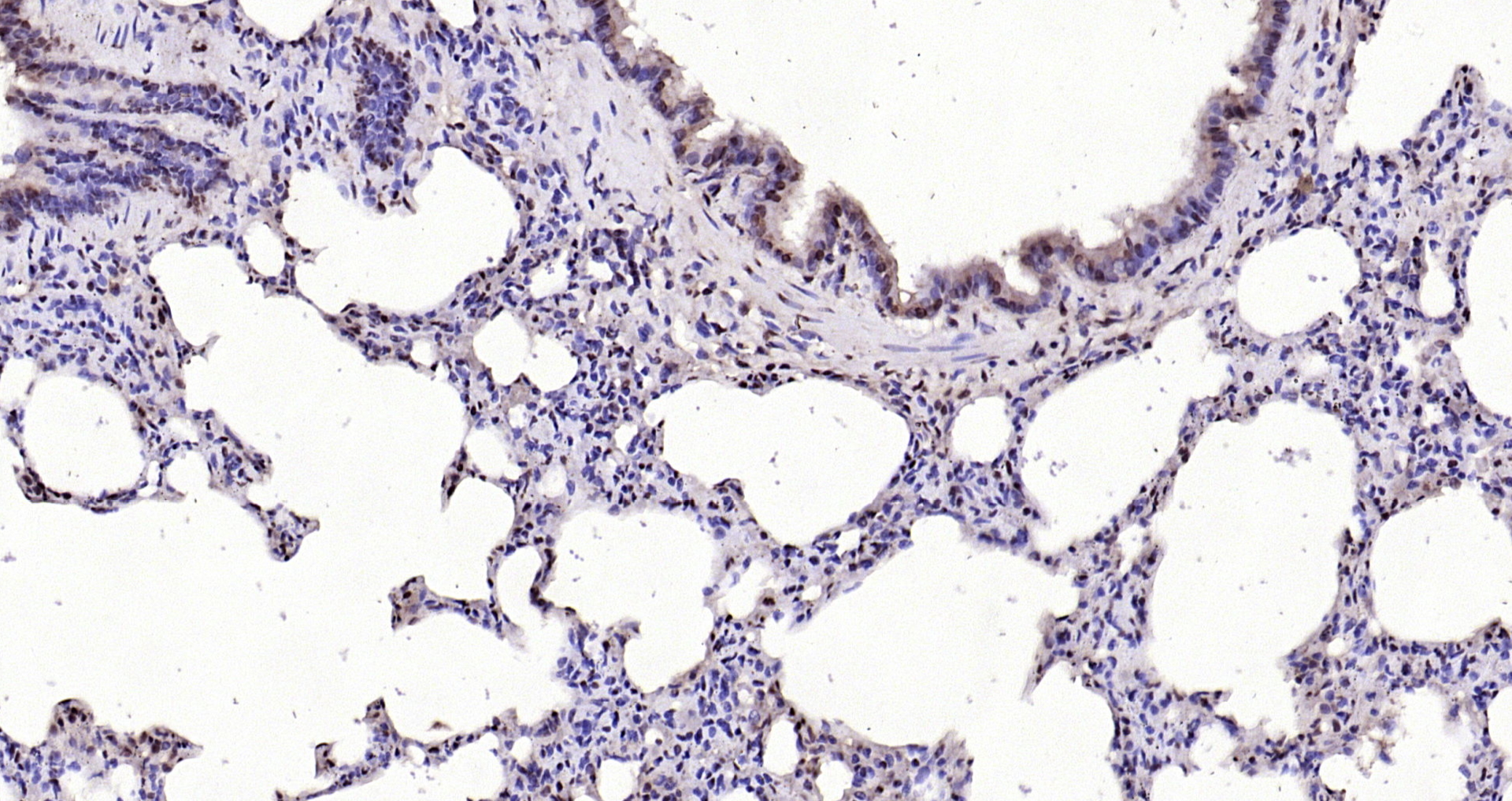Paraformaldehyde-fixed, paraffin embedded Rat lung; Antigen retrieval by boiling in sodium citrate buffer (pH6.0) for 15min; Block endogenous peroxidase by 3% hydrogen peroxide for 20 minutes; Blocking buffer (normal goat serum) at 37°C for 30min; Antibody incubation with IL-33 Polyclonal Antibody, Unconjugated (bs-2633R) at 1:200 overnight at 4°C, DAB staining.