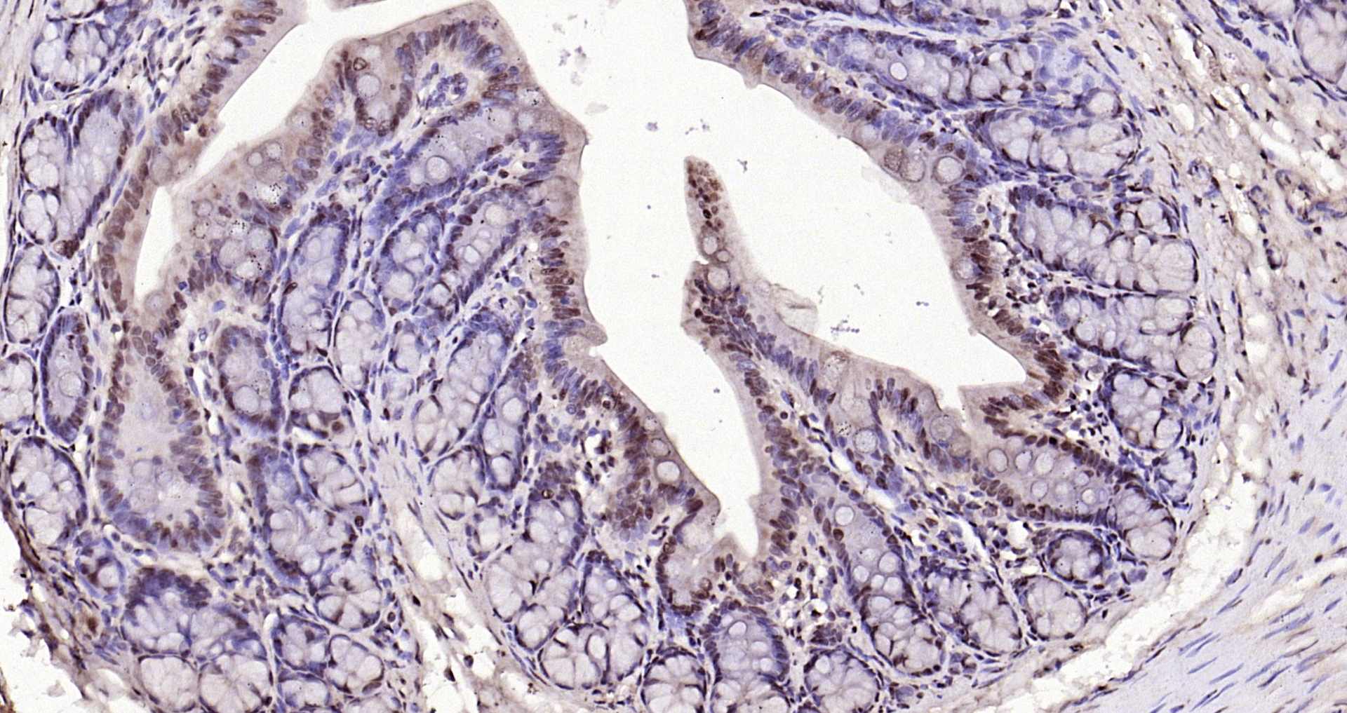 Paraformaldehyde-fixed, paraffin embedded Rat colon; Antigen retrieval by boiling in sodium citrate buffer (pH6.0) for 15min; Block endogenous peroxidase by 3% hydrogen peroxide for 20 minutes; Blocking buffer (normal goat serum) at 37°C for 30min; Antibody incubation with IL-33 Polyclonal Antibody, Unconjugated (bs-2633R) at 1:200 overnight at 4°C, DAB staining.