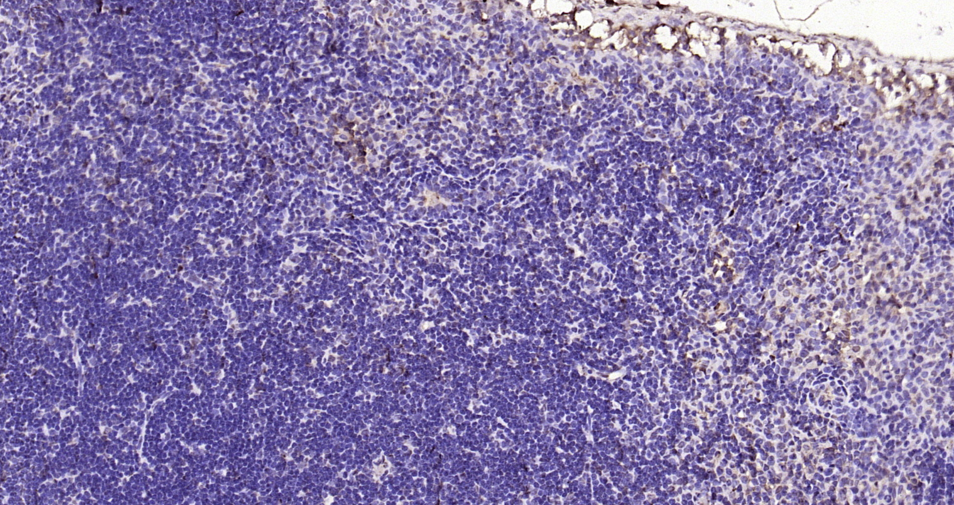 Paraformaldehyde-fixed, paraffin embedded Rat lymph node; Antigen retrieval by boiling in sodium citrate buffer (pH6.0) for 15min; Block endogenous peroxidase by 3% hydrogen peroxide for 20 minutes; Blocking buffer (normal goat serum) at 37°C for 30min; Antibody incubation with IL-33 Polyclonal Antibody, Unconjugated (bs-2633R) at 1:200 overnight at 4°C, DAB staining.