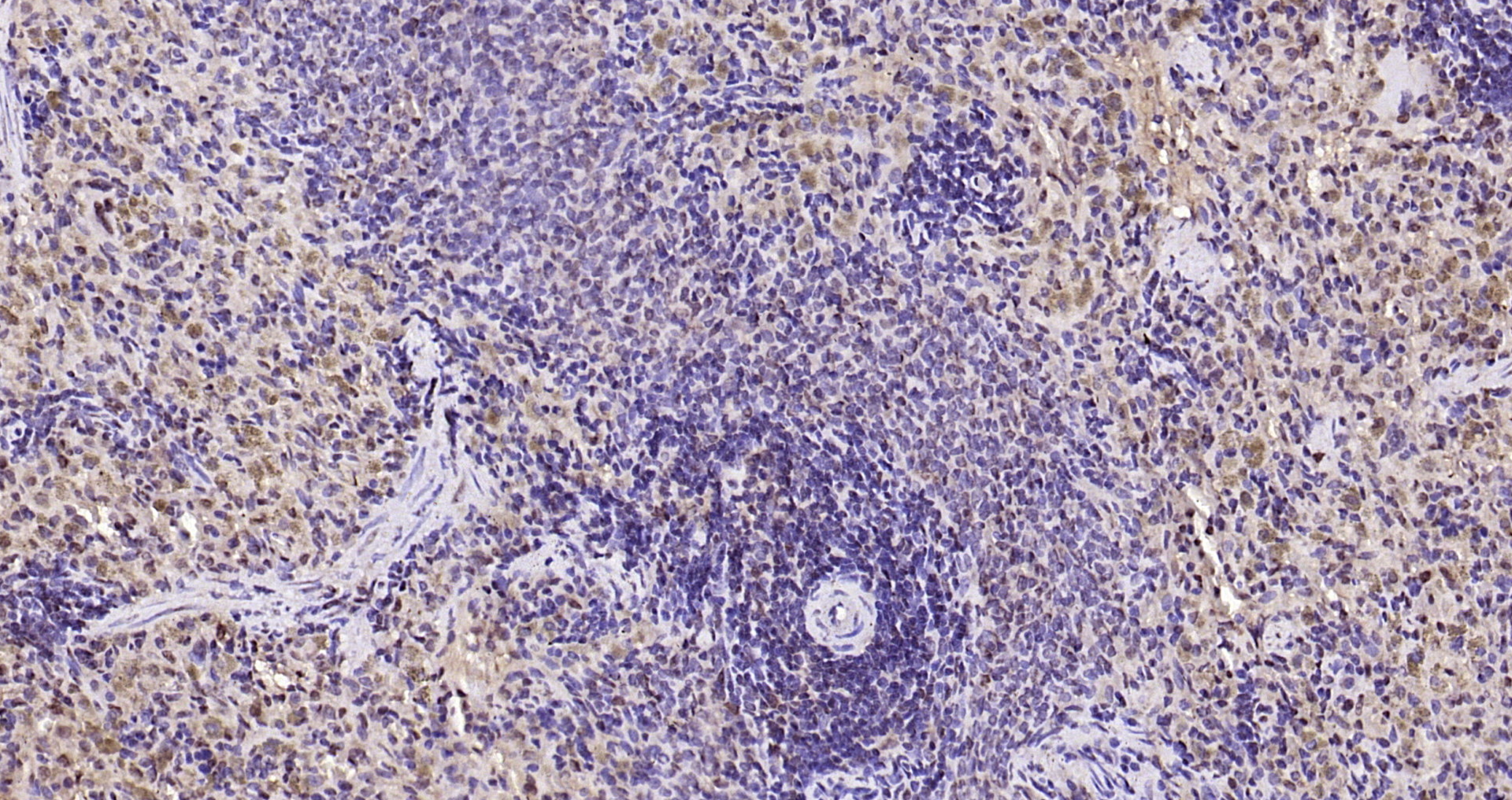 Paraformaldehyde-fixed, paraffin embedded Rat spleen; Antigen retrieval by boiling in sodium citrate buffer (pH6.0) for 15min; Block endogenous peroxidase by 3% hydrogen peroxide for 20 minutes; Blocking buffer (normal goat serum) at 37°C for 30min; Antibody incubation with IL-33 Polyclonal Antibody, Unconjugated (bs-2633R) at 1:200 overnight at 4°C, DAB staining.