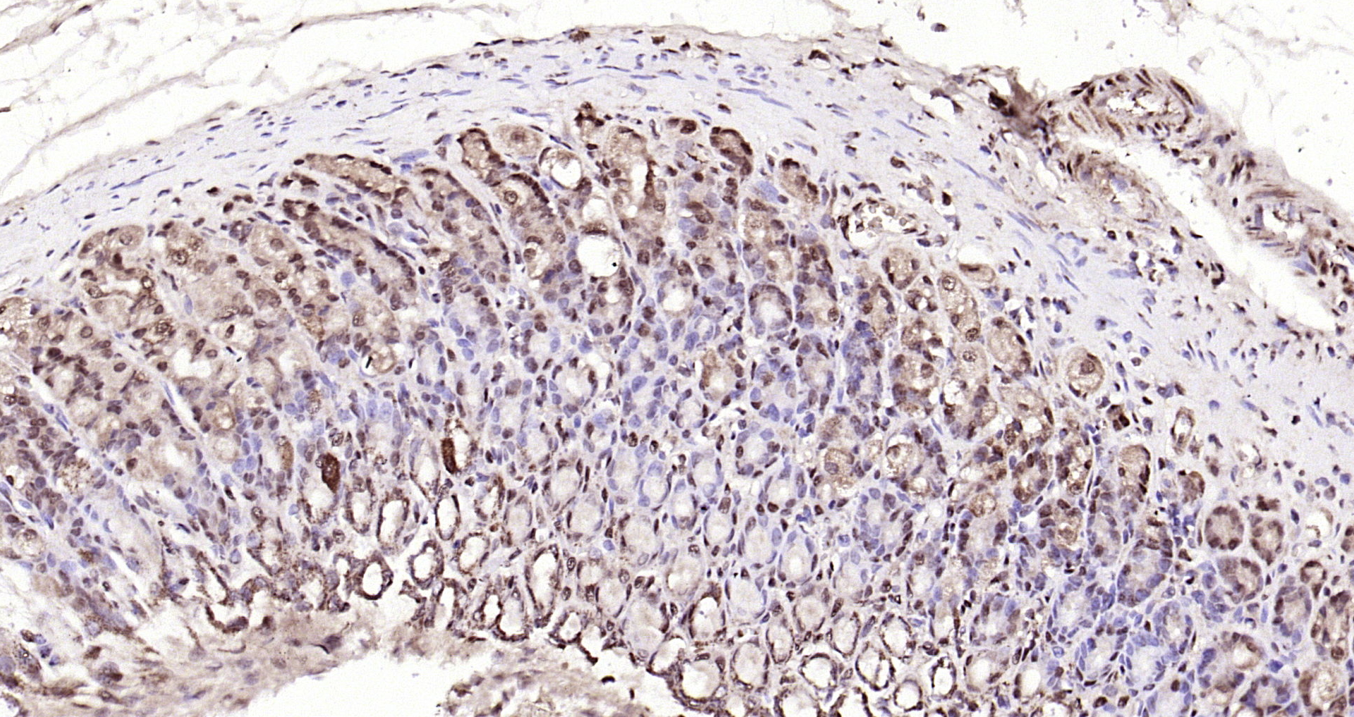 Paraformaldehyde-fixed, paraffin embedded Rat stomach; Antigen retrieval by boiling in sodium citrate buffer (pH6.0) for 15min; Block endogenous peroxidase by 3% hydrogen peroxide for 20 minutes; Blocking buffer (normal goat serum) at 37°C for 30min; Antibody incubation with IL-33 Polyclonal Antibody, Unconjugated (bs-2633R) at 1:200 overnight at 4°C, DAB staining.