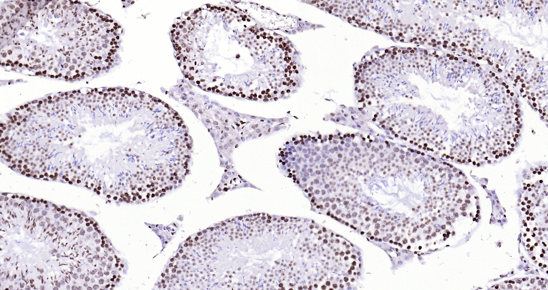 Paraformaldehyde-fixed, paraffin embedded Mouse testis; Antigen retrieval by boiling in sodium citrate buffer (pH6.0) for 15min; Block endogenous peroxidase by 3% hydrogen peroxide for 20 minutes; Blocking buffer (normal goat serum) at 37°C for 30min; Antibody incubation with CENPA Polyclonal Antibody, Unconjugated (bs-2753R) at 1:200 overnight at 4°C, DAB staining.