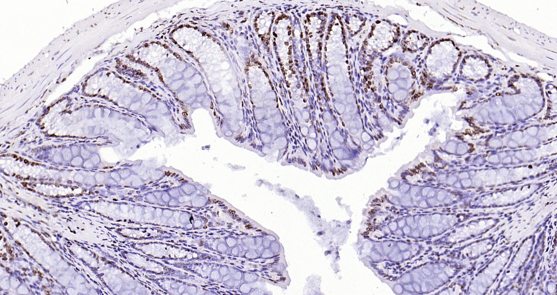 Paraformaldehyde-fixed, paraffin embedded Mouse colon; Antigen retrieval by boiling in sodium citrate buffer (pH6.0) for 15min; Block endogenous peroxidase by 3% hydrogen peroxide for 20 minutes; Blocking buffer (normal goat serum) at 37°C for 30min; Antibody incubation with CENPA Polyclonal Antibody, Unconjugated (bs-2753R) at 1:200 overnight at 4°C, DAB staining.