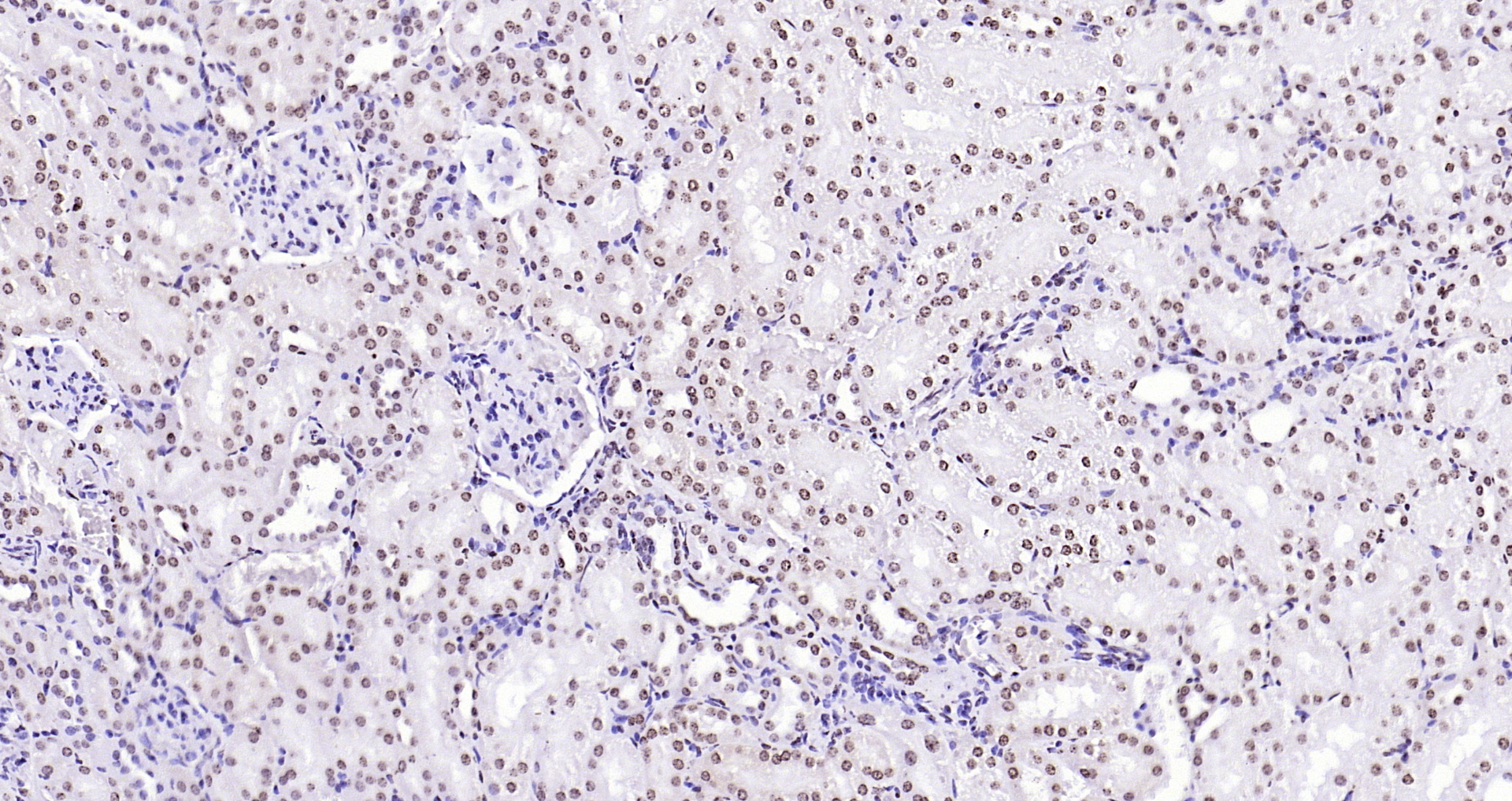Paraformaldehyde-fixed, paraffin embedded Mouse kidney; Antigen retrieval by boiling in sodium citrate buffer (pH6.0) for 15min; Block endogenous peroxidase by 3% hydrogen peroxide for 20 minutes; Blocking buffer (normal goat serum) at 37°C for 30min; Antibody incubation with CENPA Polyclonal Antibody, Unconjugated (bs-2753R) at 1:200 overnight at 4°C, DAB staining.